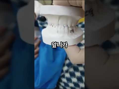 4세 아동 반대교합(거꾸로 물리는 치아) 이렇..